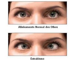 imagem-3329