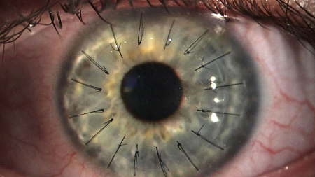 imagem-17213